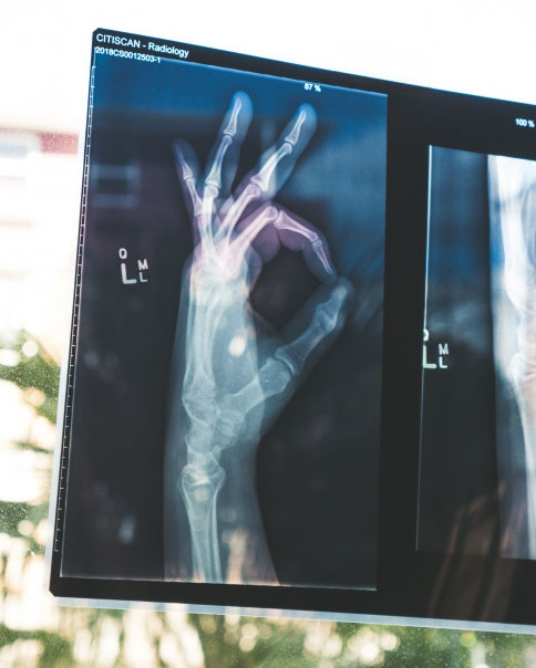 xray